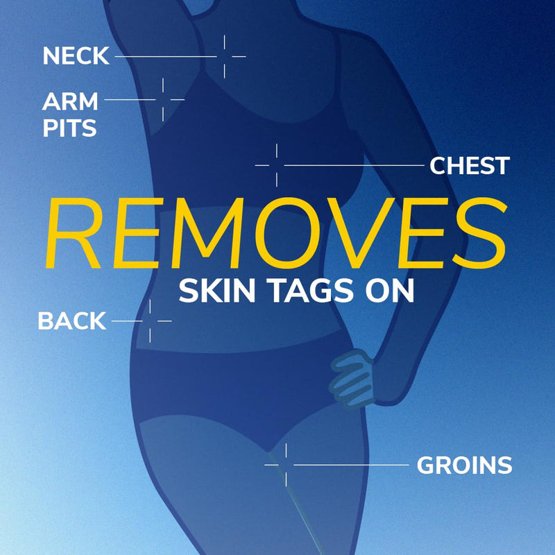Scholl Freeze Away Skin Tag Removal Kit - Removes Skin Tags in As Little As 1 Treatment