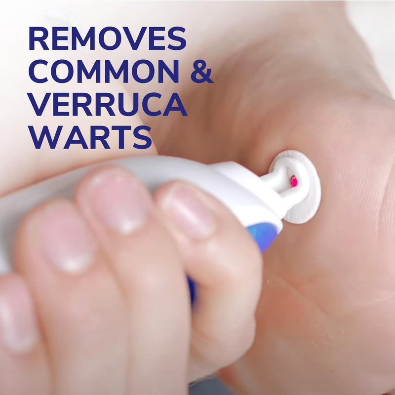 Dr. Scholl's Freeze Away Max Verruca and Wart Remover for Hands and Feet - As Fast As 10 Seconds to Treat Warts and Verrucas, Safe for Children Aged 4 and Above
