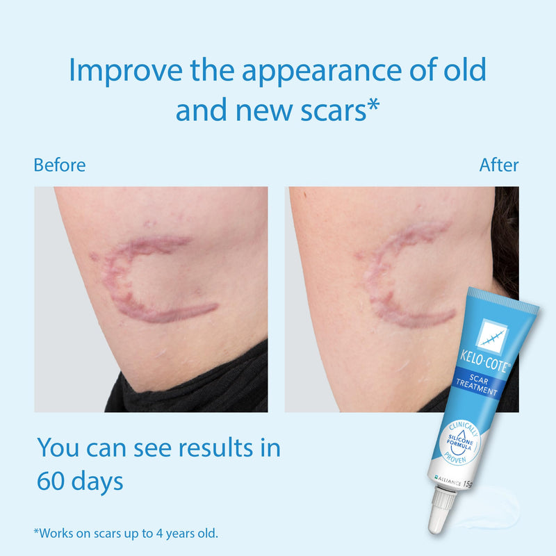 KELO-COTE Advanced Formula Scar Gel, 60g