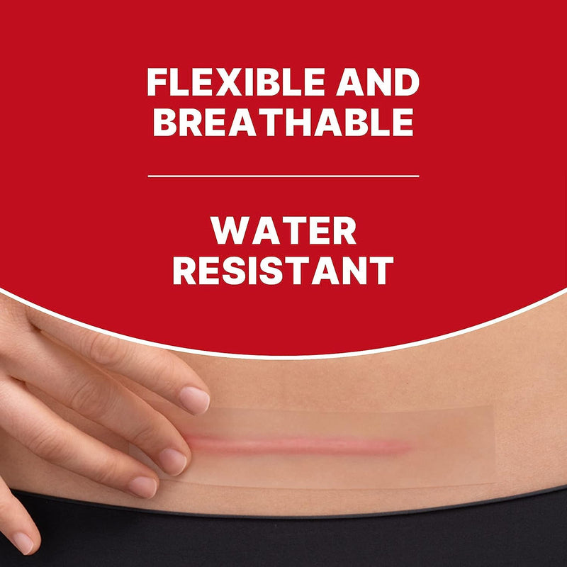 Elastoplast Scar Reducer Plasters (21 Plasters), Quick and Convenient Scar Cover Up Treatment, Scar Sheets to Reduce Visibility of Scars, Scar Plaster Pack for Quick Results, Strong Adhesion Tape