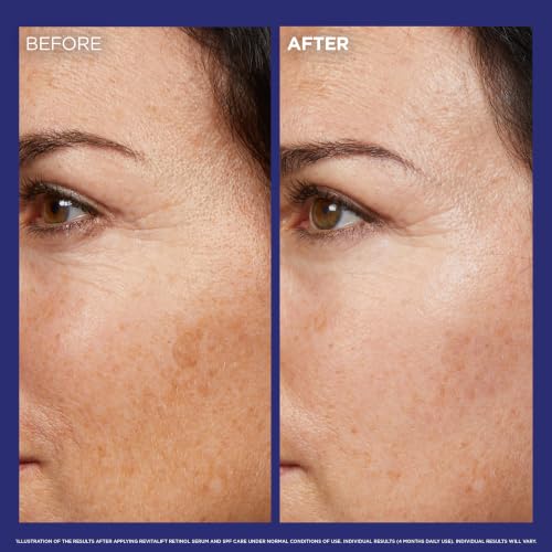 L'Oréal Paris Retinol Serum for Face, Revitalift Laser Anti-Wrinkle 30ml