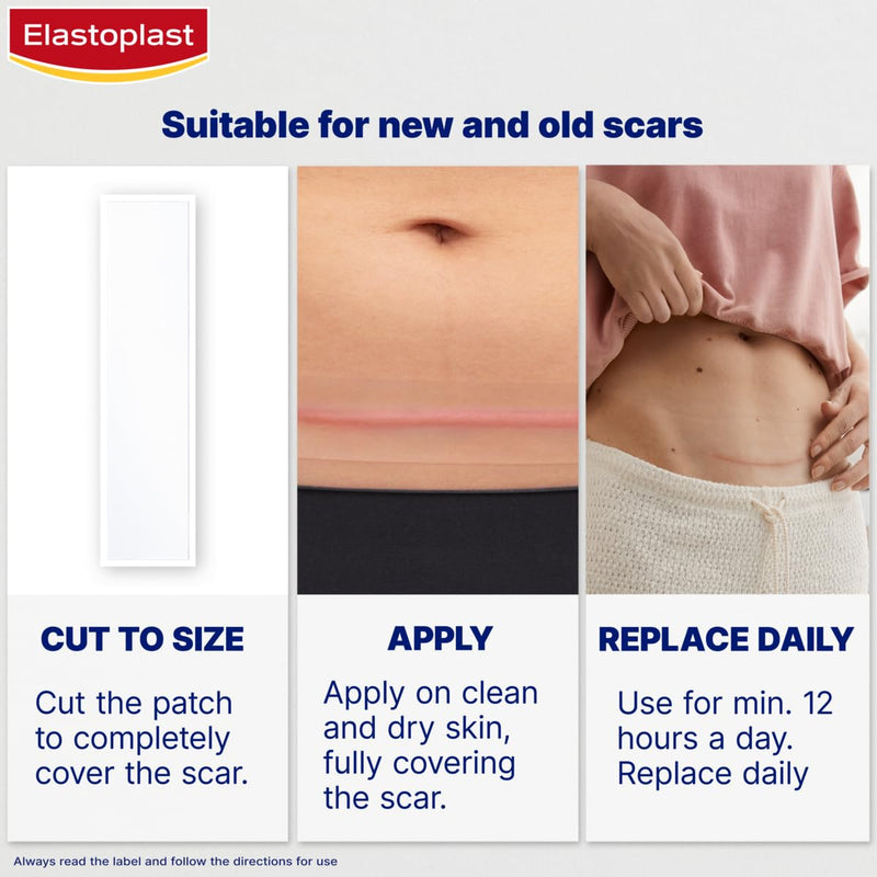 Elastoplast Scar Reducer Plasters (21 Plasters), Quick and Convenient Scar Cover Up Treatment, Scar Sheets to Reduce Visibility of Scars, Scar Plaster Pack for Quick Results, Strong Adhesion Tape