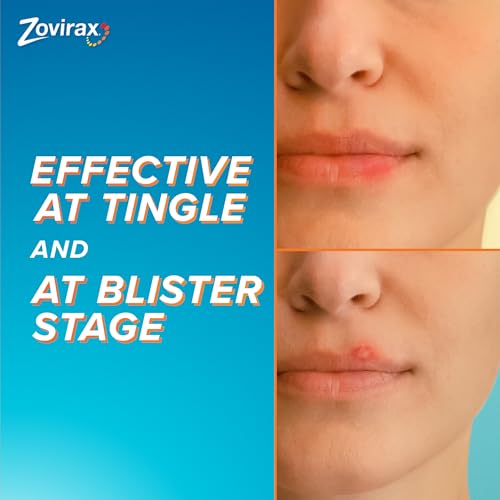 Zovirax Cold Sore Cream for Lips, with Aciclovir, Cold Sore Cream Treatment, Pain Relief, Pump 2g