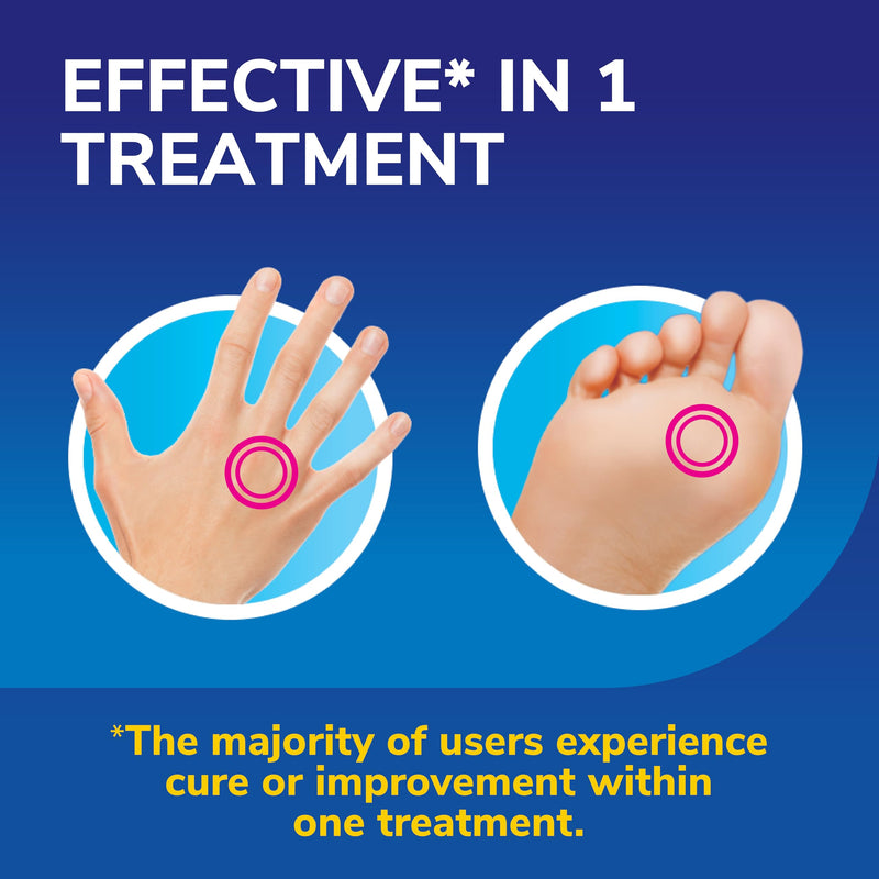 Dr. Scholl's Freeze Away Max Verruca and Wart Remover for Hands and Feet - As Fast As 10 Seconds to Treat Warts and Verrucas, Safe for Children Aged 4 and Above