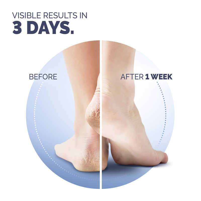 Scholl Cracked Heel Repair Cream 60 ml