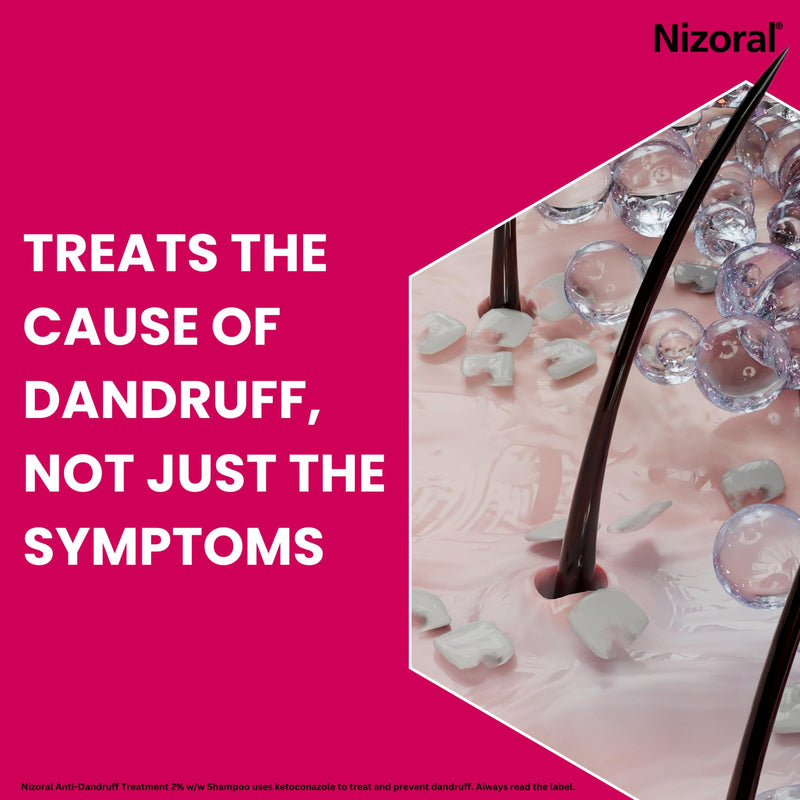 Nizoral Anti-Dandruff Treatment Shampoo, Treats and Prevents Dandruff, Clinically Proven to Control Itchy & Flaky Scalps, Contains Ketoconazole, 1 x 60ml