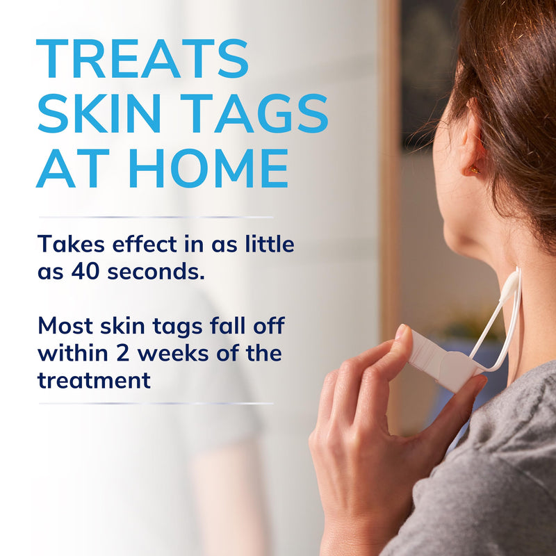 Scholl Freeze Away Skin Tag Removal Kit - Removes Skin Tags in As Little As 1 Treatment