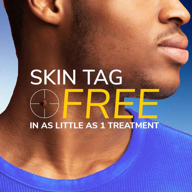 Scholl Freeze Away Skin Tag Removal Kit - Removes Skin Tags in As Little As 1 Treatment